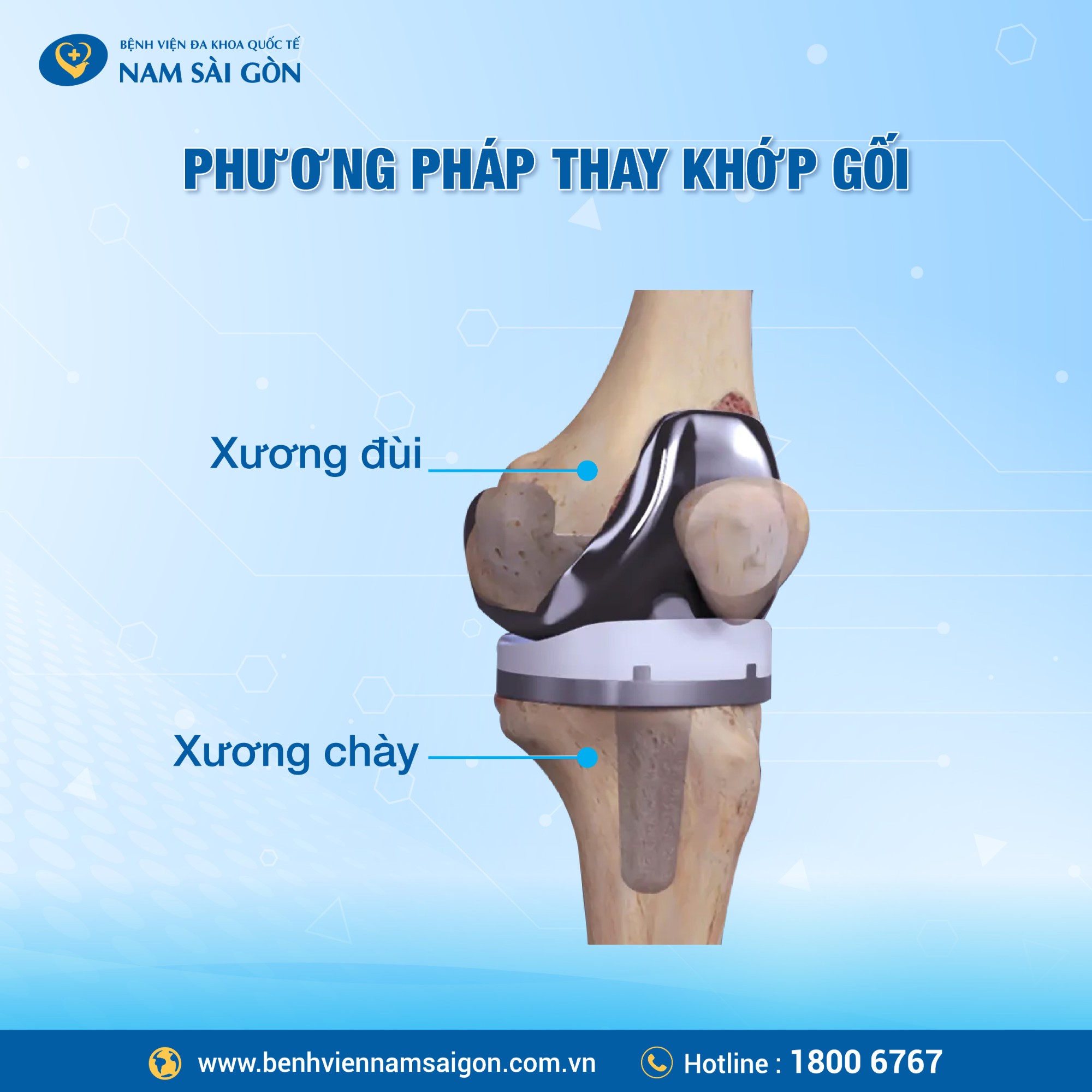 post thay khop goi va noi soi tan soi than 02 1