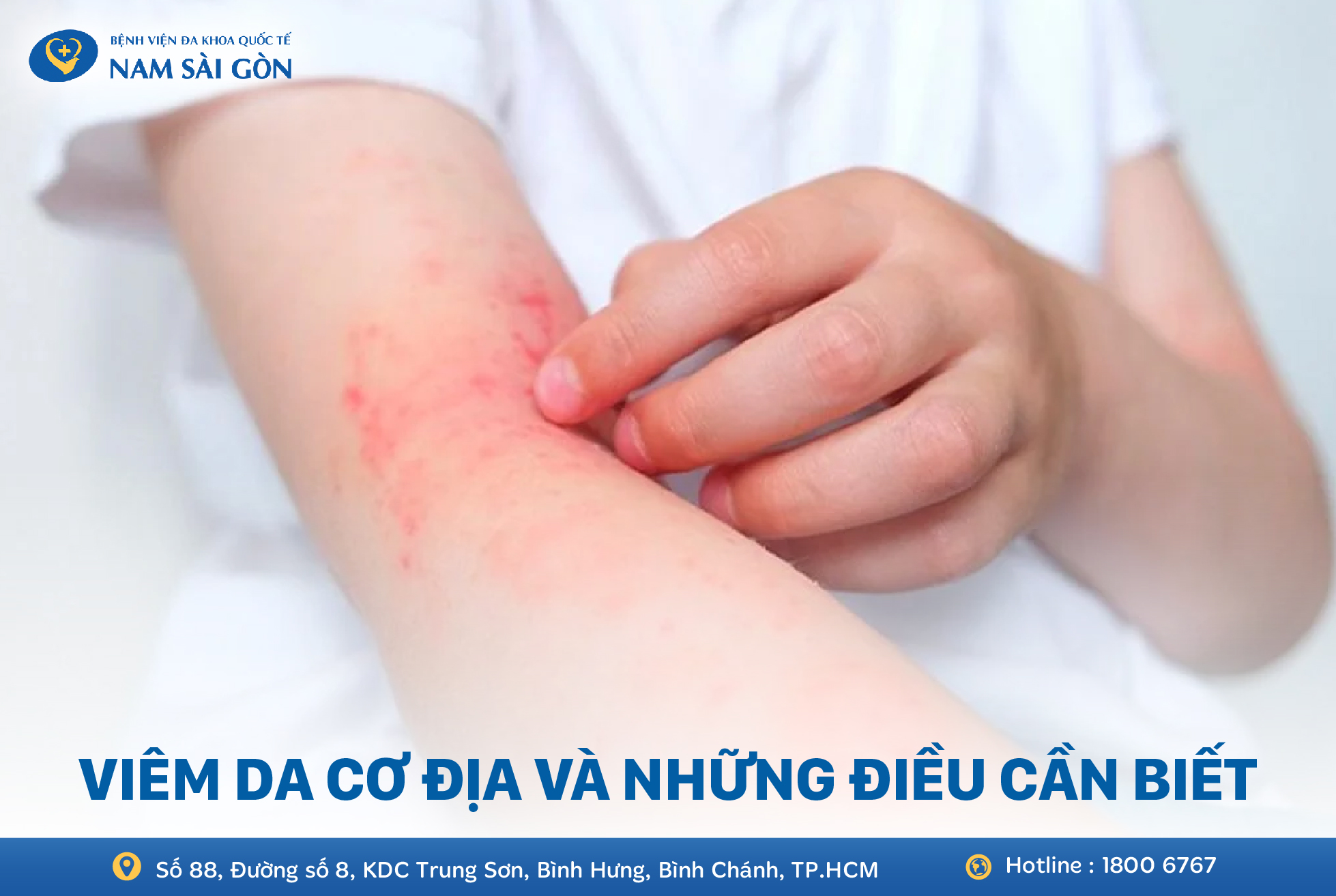 VIÊM DA CƠ ĐỊA – NGUYÊN NHÂN, NHẬN BIẾT, CHẨN ĐOÁN VÀ ĐIỀU TRỊ